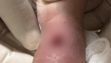 Viral tangan bayi bengkak hingga berlubang usai diinfus di RSIA Paramount Makassar. Foto: (dok. istimewa)


