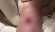 Viral Tangan Bayi Bengkak Usai Diinfus di RS Paramoun Makassar, Manajemen Beri Klarifikasi